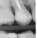 Sure Band Starter Kit